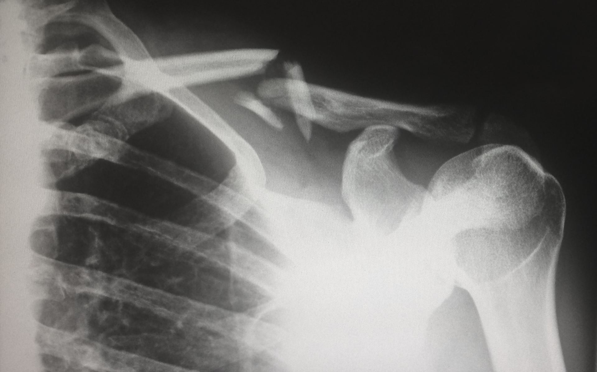 x ray