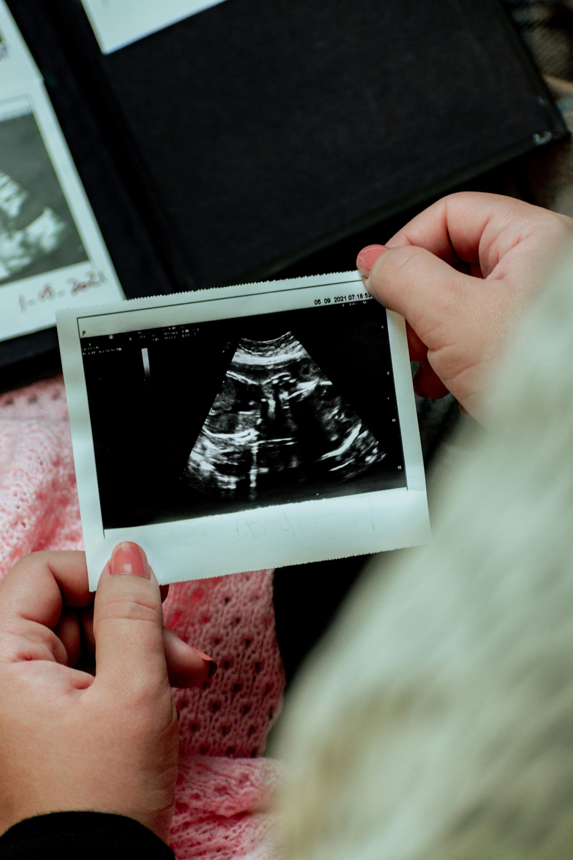 womens hand holding an ultrasound of a baby