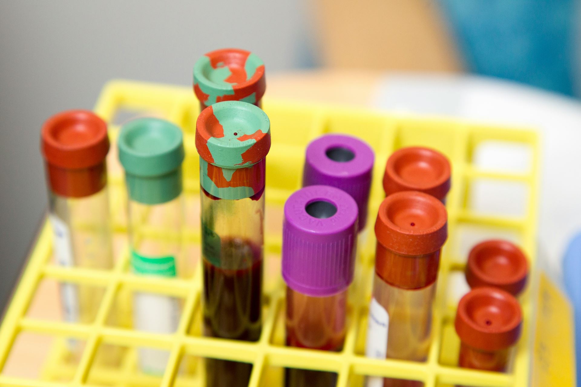 blood vials in holder